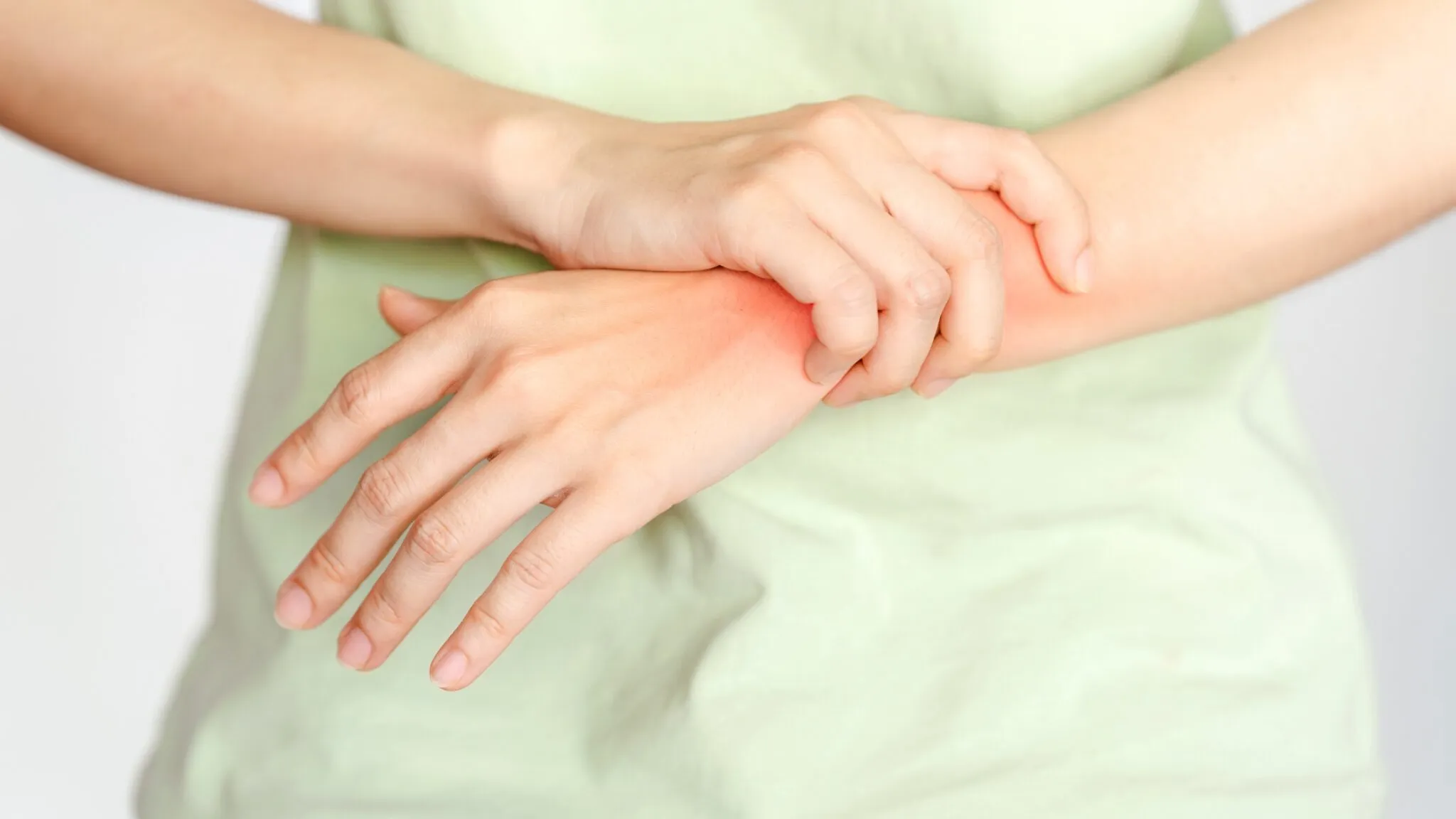 A person's hands, one grasping the other's wrist which shows a red, irritated patch on the skin.